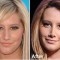 Plastic Surgery, Depression, Death | 3 Reasons Women Risk Their Lives