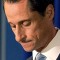 Is Anthony Weiner suffering from Mental Illness? | 5 Things to know about Exhibitionism